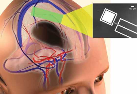 power-extraction-from-cerebrospinal-fluid power-extraction-from-cerebrospinal-fluid