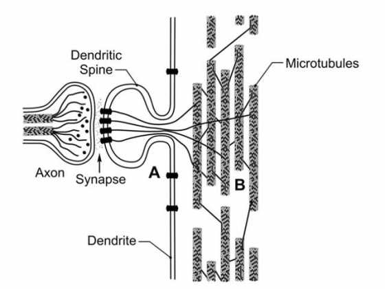 ultrasound-brain-11 ultrasound-brain-11