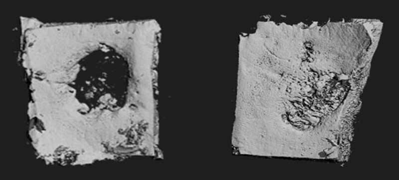 bone-regeneration-aerial bone-regeneration-aerial