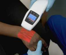 accuvein-portable-vein-illumination-device-finding-veins-much-easier.jpg accuvein-portable-vein-illumination-device-finding-veins-much-easier.jpg