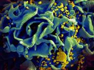 hiv-infected-t-cell