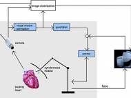 MIHS compensation system compensates  movements due to breathing and heart beating