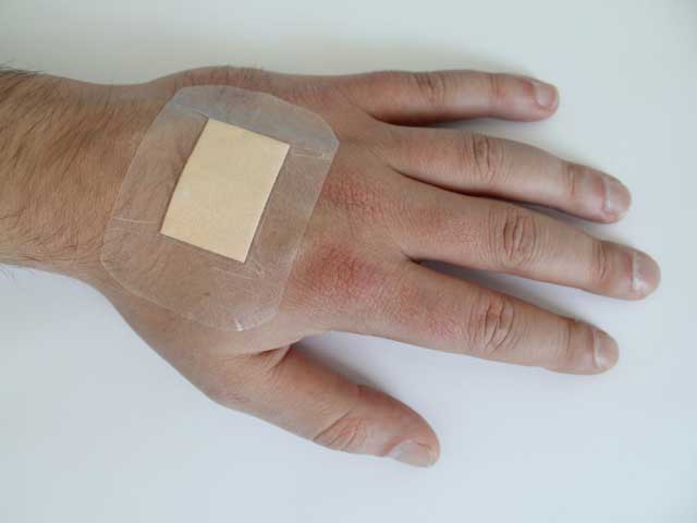Dressings For Wounds. a surgical wound or a