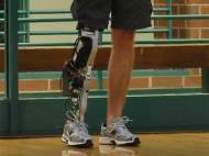 lower-limb-prosthetic-goldfarbhutto