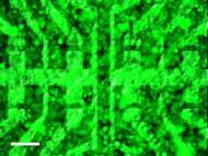 tum-bioelectronics-graphene-based-transistor-array