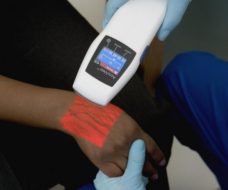 accuvein-portable-vein-illumination-device-finding-veins-much-easier.jpg