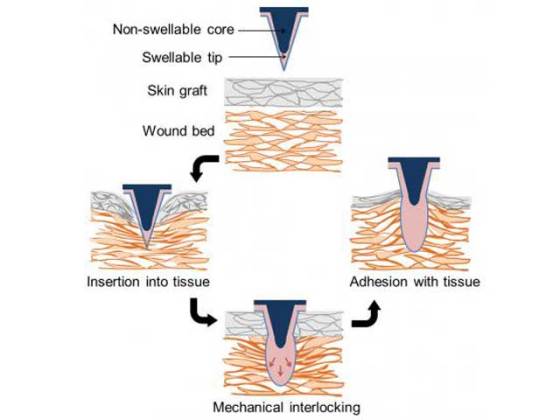 adhesive-microneedle-2