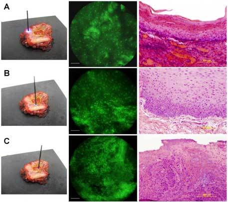 consumer-grade-camera-used-to-detect-cancer-2