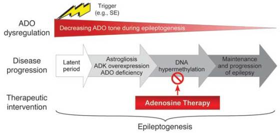 silk-implant-epilepcy-2