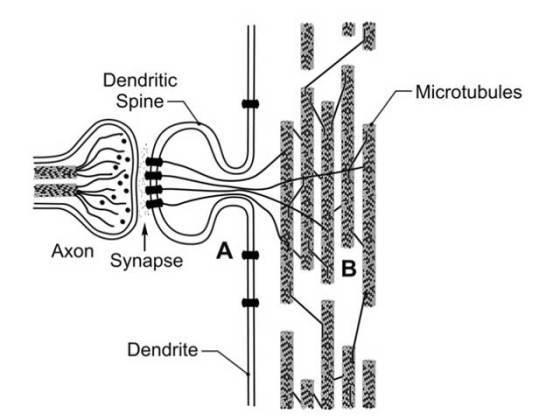 ultrasound-brain-11