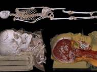 virtual-3d-autopsy-table2